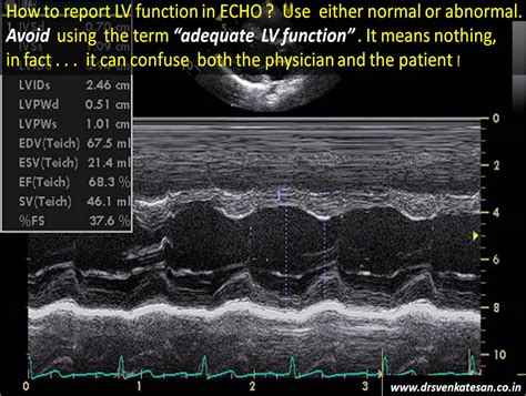 lv systolic function echo